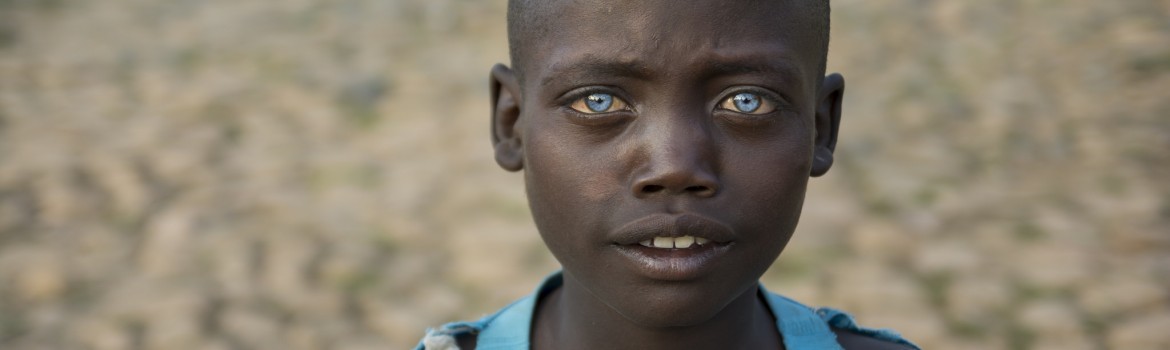 ABUSHE, THE ETHIOPIAN CHILD WITH BLUE EYES
